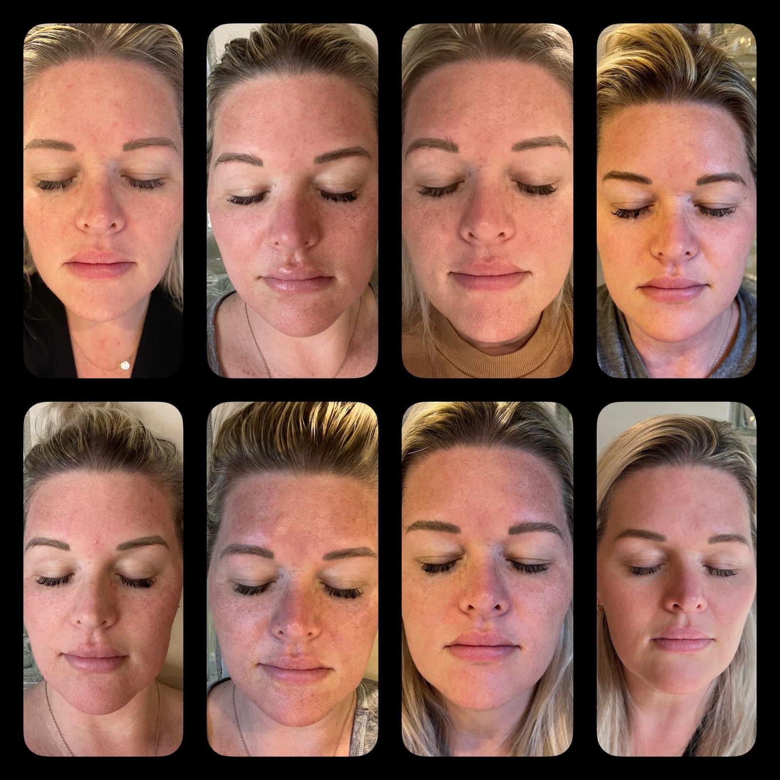 Halo, Patient 2 LIV Wellness Lounge, Inc