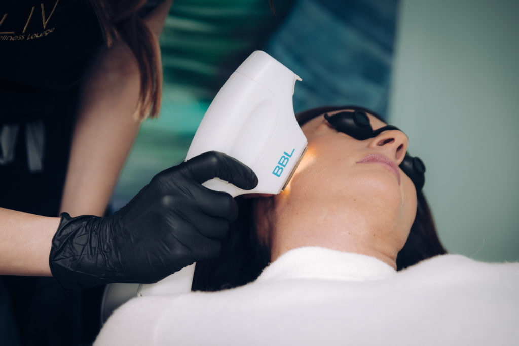 IPL Treatment (BBL® HERO™) in Bellingham, Burlington & Bothell