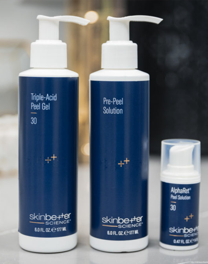 Four skincare products from Skinbe+ter Science are displayed on a table.