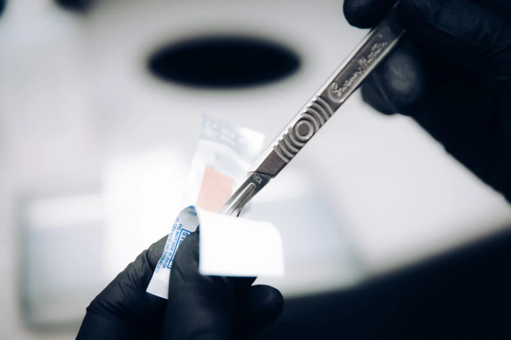 Healthcare professional preparing a sterile scalpel for a medical procedure at LIV Wellness Lounge.