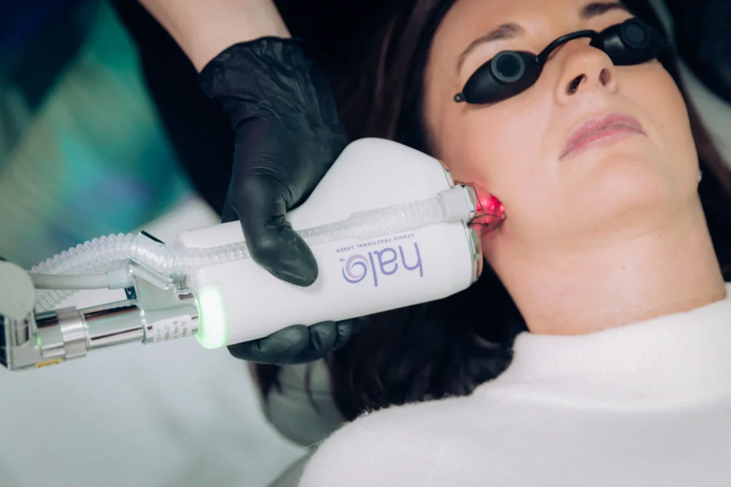 Healthcare professional performing a Halo laser treatment on a female patient's face at LIV Wellness Lounge.