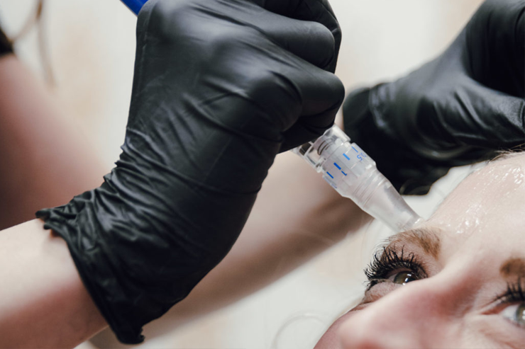 Denise, a healthcare professional, performs a close-up skincare treatment around a patient's eye using specialized equipment.