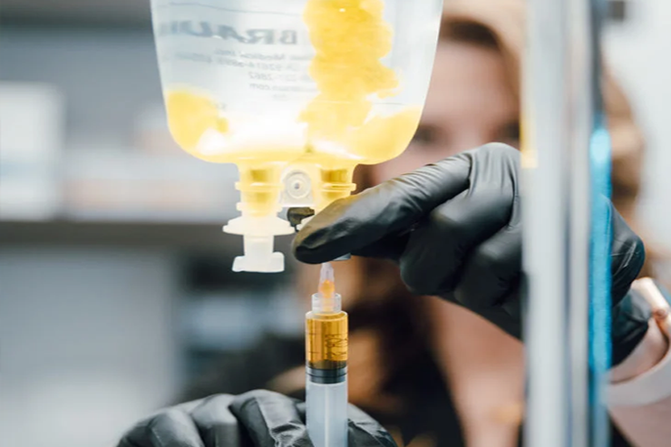 A medical professional wearing black gloves fills a syringe with liquid from an IV bag containing a yellowish solution.