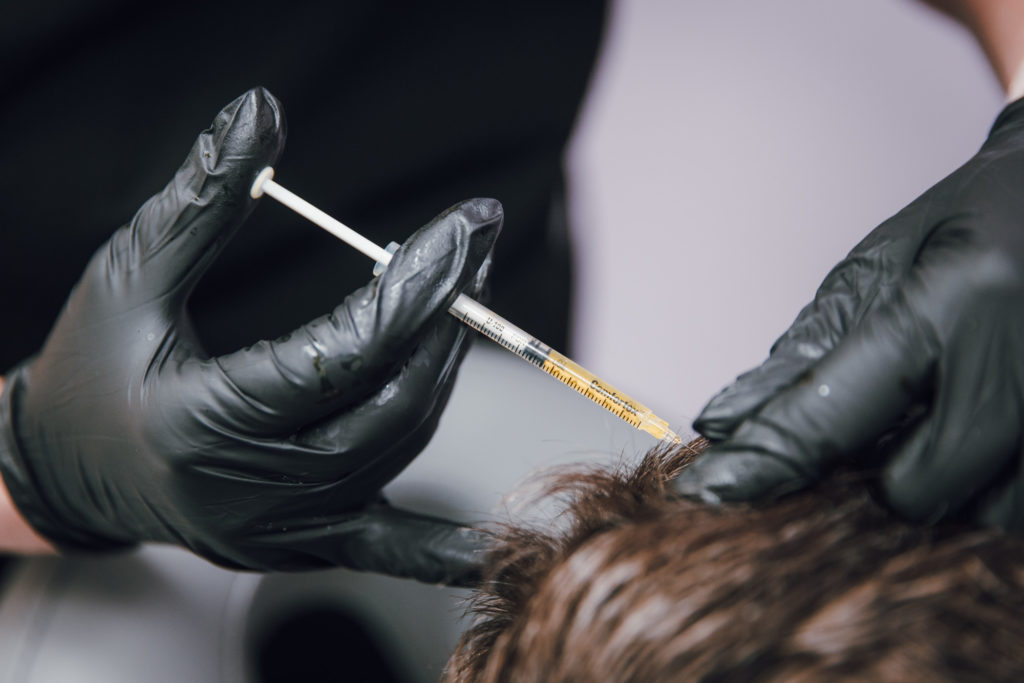 Person receiving an injection in the scalp.